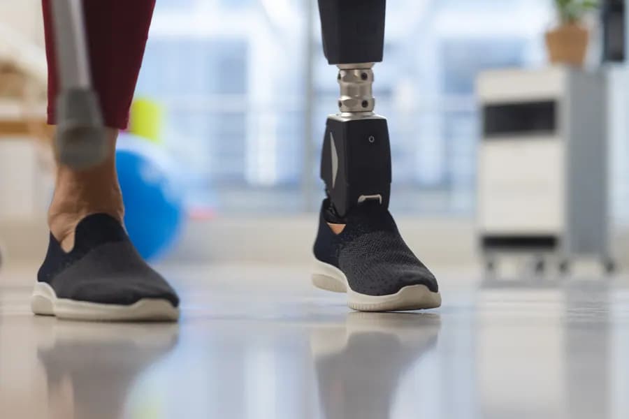 Prosthetic leg background